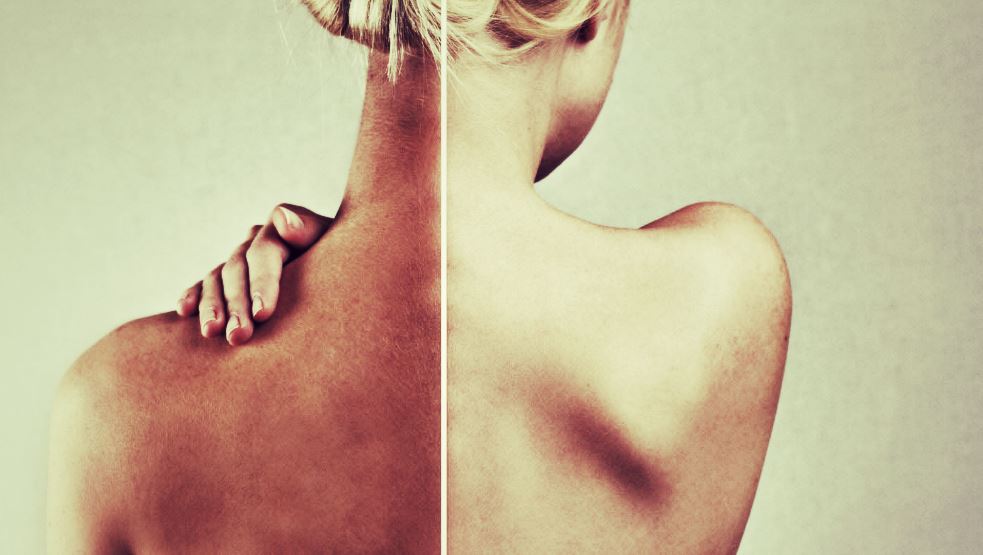 Combien de temps pour bronzer avec un indice UV 3 