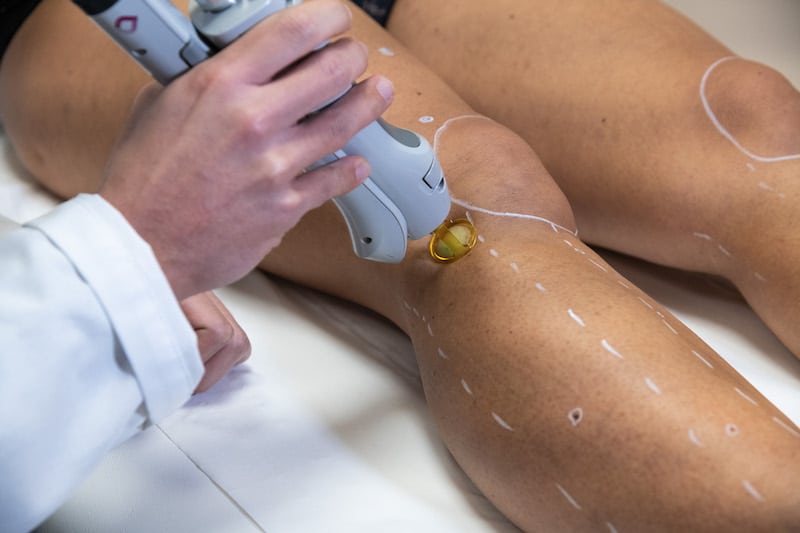 bronzer après une épilation laser 